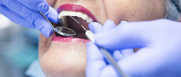 Best Weekend Emergency Dentist in Bardmoor, FL
